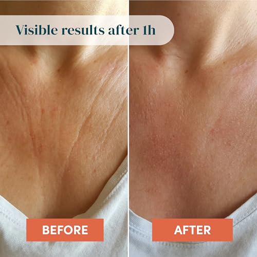 APRICOT Hyaluronic Acid Silicone Chest Wrinkle Pad 30x Reusable Anti-Aging Skin Tightening