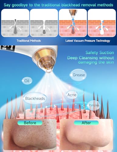 Buktailty WiFi Blackhead Remover with HD Camera & 5 Suction Levels