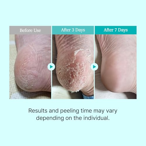Ariul Charcoal Foot Peel Mask - Exfoliating Socks for Dead Skin (2 Pairs)