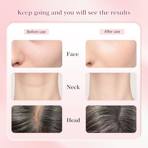 Red-Light-Therapy-for-Face and Neck-Eye-Head Massager,7 Colors Skin Rejuvenation Lifting Facial Massager for Toning,Glow Boost£¬Wrinkle for Birthday,Christmas,Mothers Day,Valentines Day Gifts (Pink)