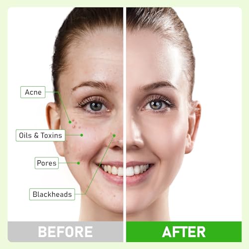 Dead Sea Mud Mask with Tea Tree Oil for Face and Body, Deep Cleansing Facial Clay Mask for Acne, Blackheads, Minimize Pores, Moisturizing, Natural Skin Care for Women and Men, 5.29oz/150g