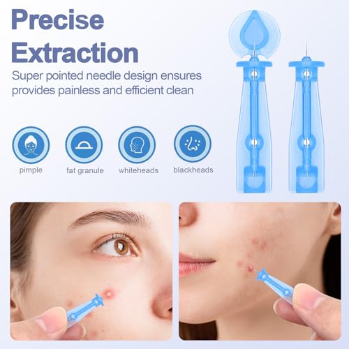 50 Pack Acne Needles & 72 Pimple Patches Sticker Set