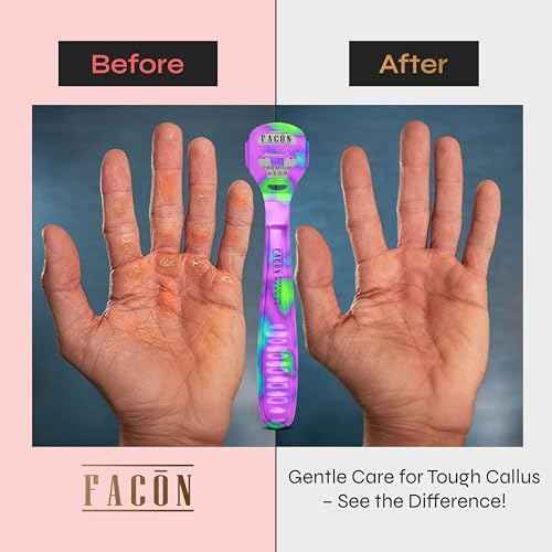Fac?n Professional Callus Shaver Remover with 50 Blades, Pedicure Razor for Feet & Hands, Foot Razor for Callus Removal, Callus Blade Remover, Corn Shaver, Surgical Grade Premium Stainless Steel Tool