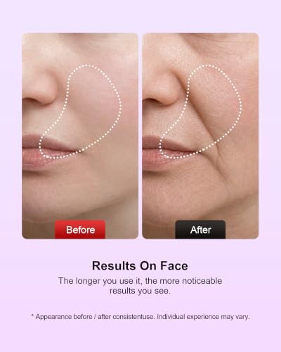 Pedete Purple LED Facial Massager for Face & Neck Light Therapy