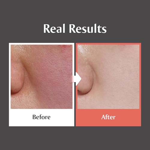 redence] 5% Niacinamide & Triple Hyaluronic Acid Skin Barrier Moisturizer Cream for Even Tone, Deep Hydration & Sensitive Skin Care, 1.69 fl oz