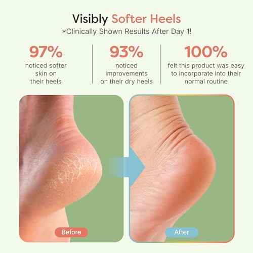 ZenToes Moisturizing Socks for Cracked Heel Treatment, Vitamin E, Olive Oil and Jojoba Oil Heel Socks, Stocking Stuffers for Women, Spa Self Care Gifts for Women (Holiday Stripes, Regular)