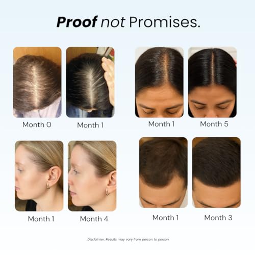 Growplex Revive Hair Strengthening Shampoo with Biotin & Caffeine - 250ml