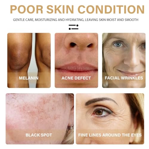 3PCS Turmeric Dark Spot Corrector Serum Oil, Repair Face Serum, Natural Turmeric Skin Dark Spot Skin Care Moisturizing Repair for Face & Body(30ml)