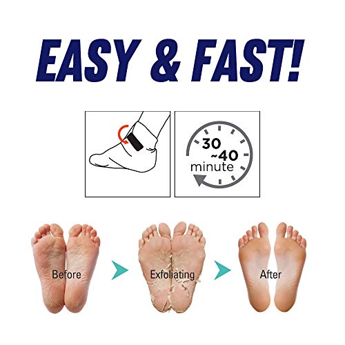 Epielle Exfoliating Foot Peel Mask - 2 Pairs for Cracked Heels & Calluses