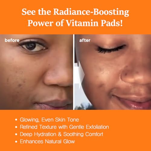 Nightingale C-toning Peeling Pads with Vitamin Complex + AHA?BHA?PHA + Niacinamide, Exfoliating Peel Pads, Sebum Care, Improve Skin Texture, Hypoallergenic, Vegan Pads, korean skin care