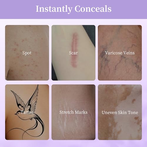 MyTend Waterproof Tattoo Cover Up Concealer for Scars & Bruises, Full Coverage Body Makeup, Long Lasting 3.5oz
