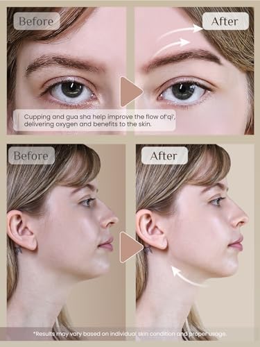 Rena Chris Facial Cupping & Gua Sha Set - Silicone Cups Rose Quartz Stone
