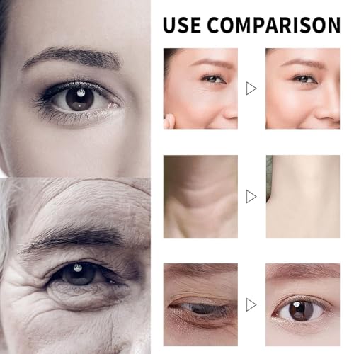 Qingling Crema Para Arrugas, Qingling Face Cream, Qingling Wrinkle Removal Cream, Polypeptide Tightening and Anti-Wrinkle Cream, Firming Anti-aging Eye Cream for Women Men (2)