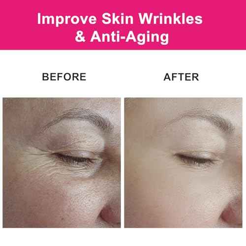 Organic Rosehip Seed Oil for Face, USDA Certified, Cold Pressed, Unrefined, 100% Pure Natural Rose Hip Oil (1oz / 30ml) for Anti-Aging, Acne Scar Treatment, Skin & Hair Care, Gua Sha Massage