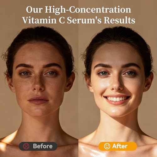 Vitamin C Facial Serum,Anti Aging & Wrinkle With Natural Vitamin C,Sodium Hyaluronate,Skin Brightening Face Serum for Dark Spots, Fine Lines & Wrinkles,All Type Skin Care 30ml/1fl.oz