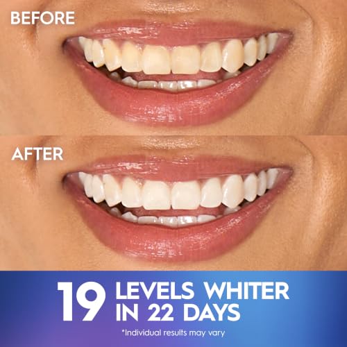 Crest 3D Whitestrips Professional Effects Teeth Whitening Kit, 22 Treatments