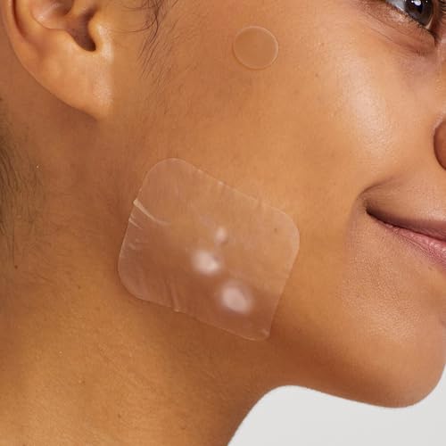 AVARELLE Pimple Patches Hydrocolloid Acne Patches, Acne Spot Treatment for Blemishes and Zit with Tea Tree Oil, Calendula Oil and Cica Oil for Face, Vegan, Cruelty Free (40 CT + 80 CT + Variety)