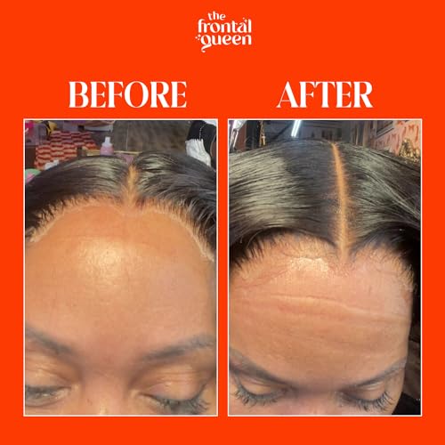 The Frontal Queen Lace Melting Spray - Strong Hold Adhesive for Lace Wigs, No Residue, Water-Resistant, 4.2 oz