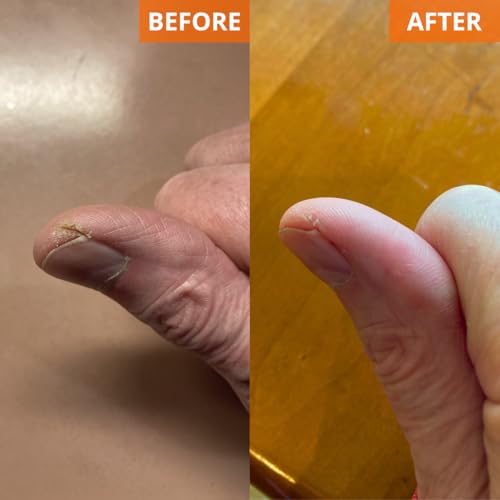 Yu-Be Moisturizing Skin Cream 4.4 Fl. Oz. Jar I Deeply Hydrating Non-Greasy Moisturizer for Dry Skin I Soothing Camphor Calms, Cools, & Relieves Skin I Vitamins Nourish, Repair & Rejuvenate