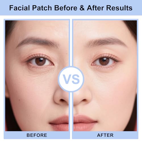 Wrinkle Patches for Forehead & Smile Lines, Overnight Anti-Wrinkle Facial Pads with Hyaluronic Acid, Niacinamide & Vitamin E ? Hydrating & Smoothing Skin Care, 36pcs
