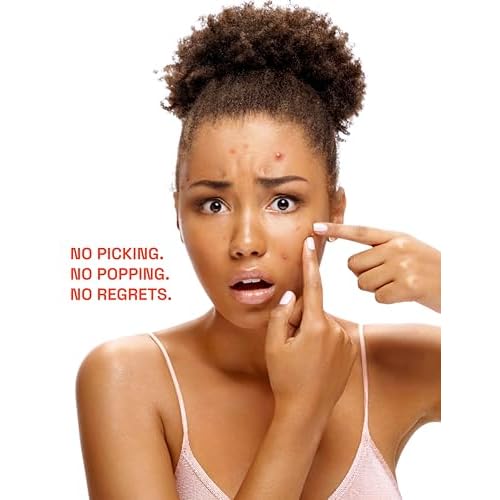 SCRAM! Acne Patches ? 100% Medical Grade Hydrocolloid Acne Pimple Patch for Zits and Whiteheads; Fast Acting Spot Patch For Face And Skin (36 Count)