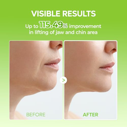 Dr.Melaxin CACTOX V-Lifting Mewing Band for Double Chin