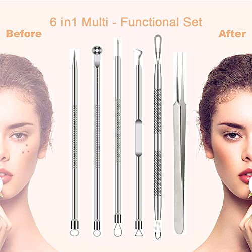 Blackhead Remover Tool Kit - 6 Pcs Acne & Blemish Extraction Set - Silver