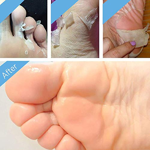 BEALUZ Lavender Exfoliating Foot Peel Mask Booties for Calluses (2 Pairs)