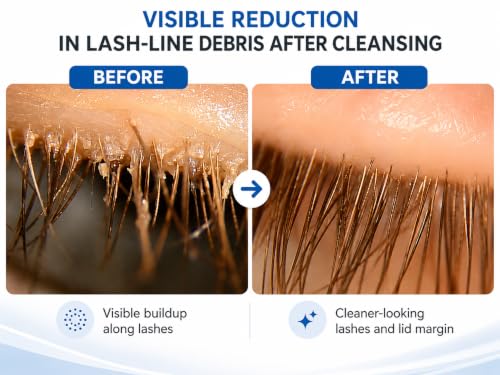 Myboclean Eyelid Cleansing Brush Kit with Gentle Gel