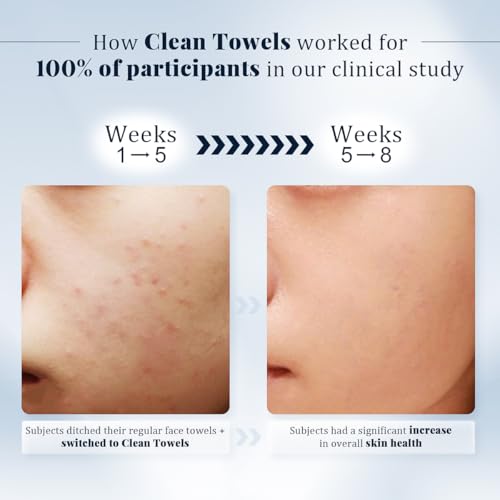Disposable Facial Towels, Soft and Highly Absorbent, Thick and Large-Sized, Lint-Free Cleansing Cloths for Daily Cleansing and Makeup Removal, 50 Count.