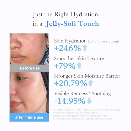 Medicube Jelly Cream - Daily Moisturizer with Hyaluronic Acid