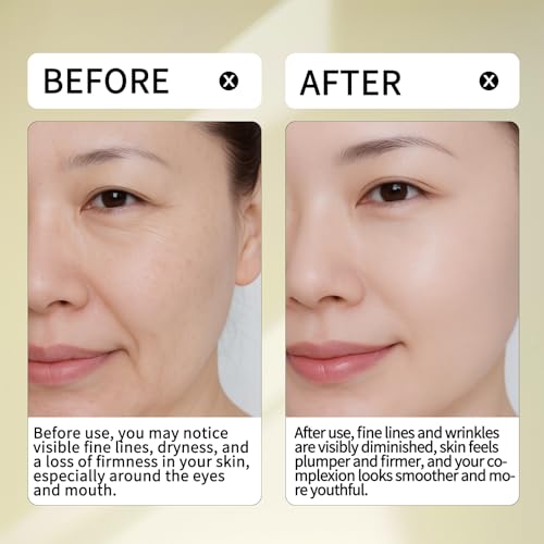 Anti-Wrinkle 18% Active Serum ? 10% Pro-Xylane, 1% Retinol, 5% Squalane & 2% Peptide Complex for Firming, Fine Line Smoothing, and Skin Barrier Repair