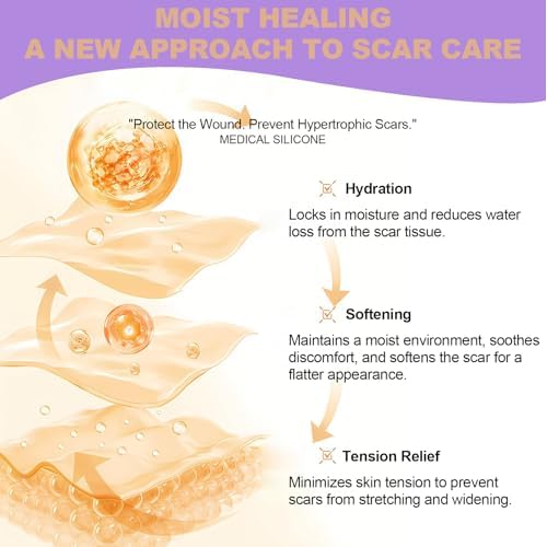 WZPB Silicone Scar Sheets for Scar Removal - Medical Grade Scar Tape for Surgical Scars, C-Section, Keloid, Hypertrophic & Acne Scars | 1.5" x 120" Reusable & Waterproof Scar Strips Roll (2 Pack)