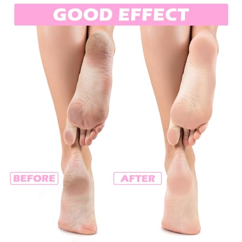 Tarpop 3 Pairs Aloe Moisturizing Gel Spa Socks for Dry Cracked Feet