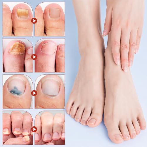 Nighttime Toenail Repair Patches - Extra Strength Foot Care (21 Pcs)