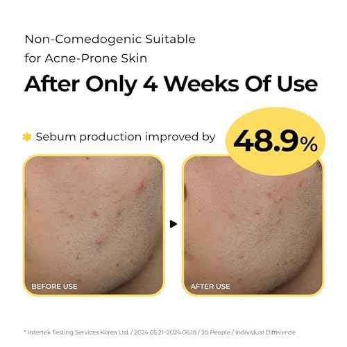 Sulfur Hot Spring Water 82% Soothing Serum with Ceramide, Panthenol, Hyaluronic acid, Hydrating, Glass skin, Non comedogenic, for Dry Skin, Acne-Prone, Korean Skin Care (1.79 fl.oz. 53ml)