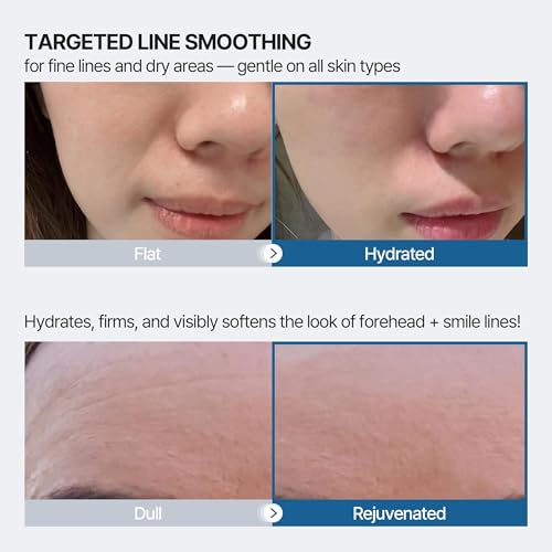 Wrinkle Patches for Forehead and Smile Line Patches 18 PCS with Hyaluronic Acid, Collagen, Peptides - Anti Wrinkle Patches - Face Tape for Wrinkles Overnight - Smoothing, Firming & Moisturizing