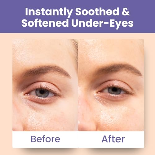 Patchology Soothing Eye Patches for Puffy Eyes & Dark Circles