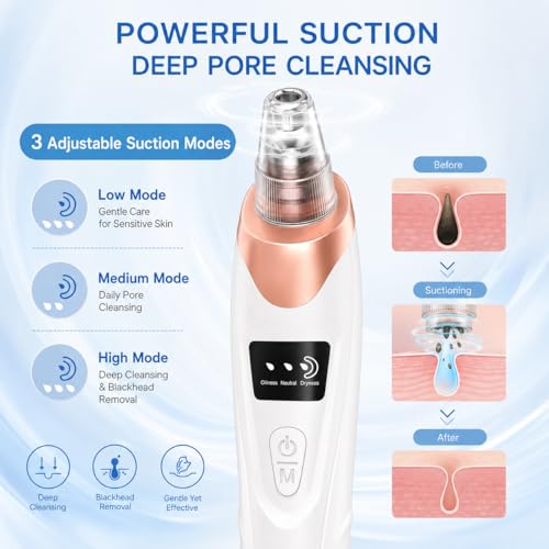 Pore Vacuum Blackhead Remover - 69kPa Suction, 3 Levels, 5 Heads
