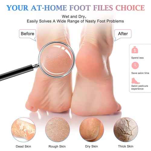 HOFASON 4Pcs Pedicure Foot Files Callus Remover with Double Sided, Professional Foot Scrubber for Feet at Home or Salon Care, Can Be Used On Both Dry and Wet Feet for Dead Skin (Blue&Pink)