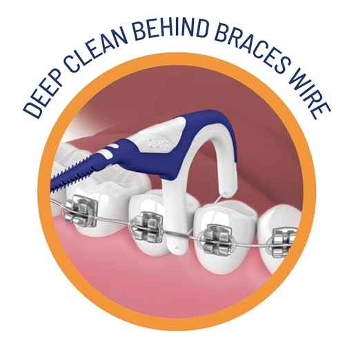OrVance Braces Flosser - Designed for Braces for an Easy & Effective Clean, Ultra Strong Floss - 40 Count (Pack of 2)