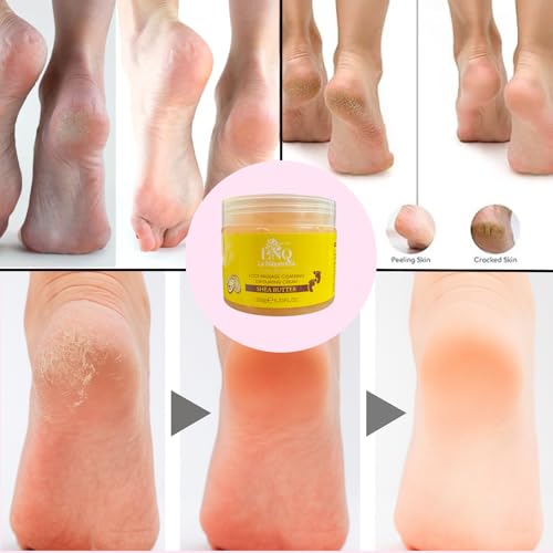 Foot Exfoliating Gel for Dry Cracked Heels - Dead Skin Remover Gel