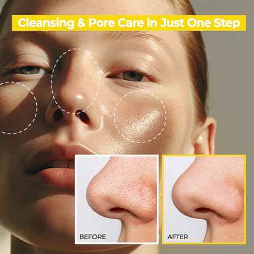 AVCA Blackhead Remover Cleansing Oil 10.14 fl.oz.(300ml) - Makeup & Blackhead Remover, PHA Gentle Exfoliator, Lightweight Pore Cleanser, Korean Skincare for Normal & Oily Skin