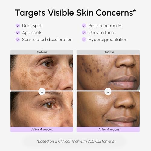 MAREE Dark Spot Remover for Face and Body ? Dark Spot Corrector Serum ? Hyperpigmentation, Melasma, Sun & Age Spots ? Black & Brown Spot Remover for Women ? Crema para Manchas Oscuras en la Cara