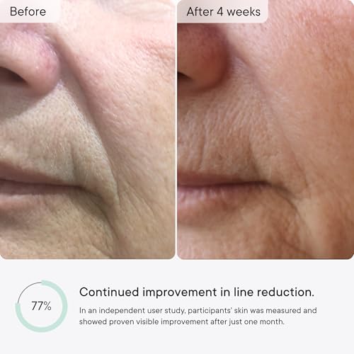 Qure Micro-Infusion Under Eye Patches with Retinol & Peptides - 8 Pairs