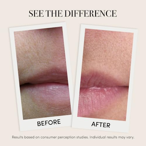 reVive Lux Lip Plumper Device with LED Light Therapy for Smooth & Hydrated Lips