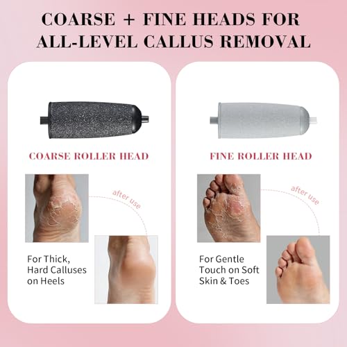 Electric Foot Callus Remover with Dual Roller Heads & LED Light