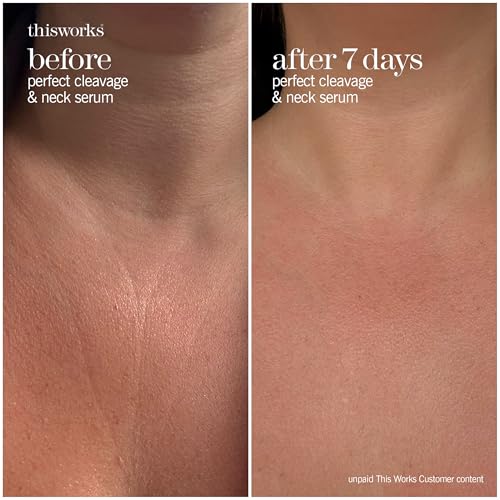 THISWORKS Perfect Cleavage & Neck Serum with Marine Algae & Hyaluronic Acid ? Neck Cream Firms & Hydrates ? 5 fl oz