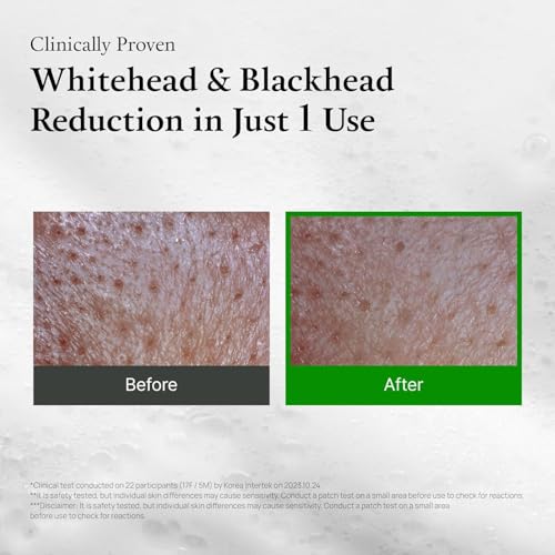 Green Tomato Clay Mask with Brush | Pore Cleanser