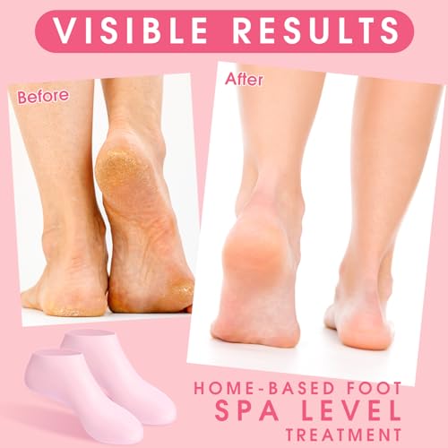 Silicone Moisturizing Socks for Dry Cracked Feet - 6 Pairs Gel Foot Mask
